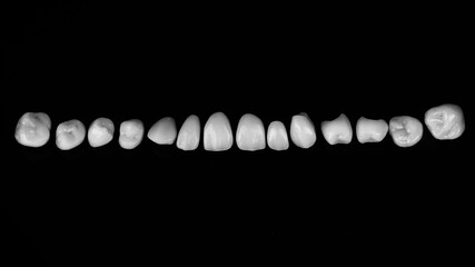 set of high esthetics ceramic veneers for the upper jaw, shot from above on a black background in black and white style © Dental Pro Content
