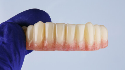 lower jaw prosthesis in the hand of an orthopedist with a blue glove on a white background