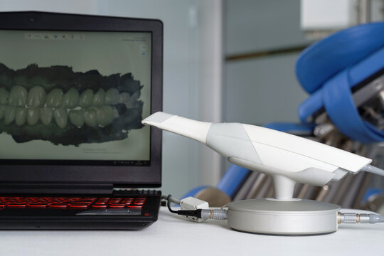 dental scanner for intraoral scanning and laptop for software processing