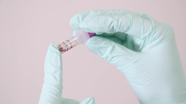 Blood testing, plr test, coronavirus concept. The nurse is looking at blood sample at the doctor office.
