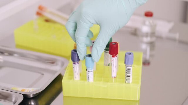 doing blood test sample  for safety doctor woman patient hand medical nurse medicine care health hospital people injection treatment massage bandage clinic body child pain therapy beautiful white heal