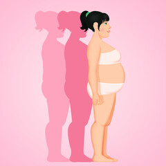 illustration of obese woman