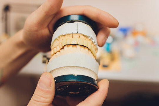 The Process Of Making A Dental Prosthesis In A Dental Laboratory.