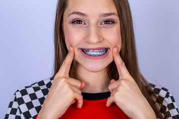 Teenager with smile shows white teeth with braces. white background.
