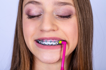 Dentist and orthodontist concept. Girl with braces cleaning teeth using brushes