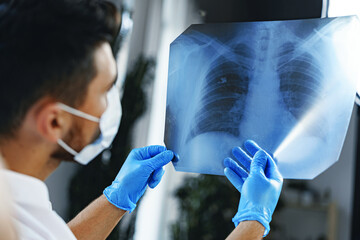 Male doctor examines an x-ray of lungs in hospital