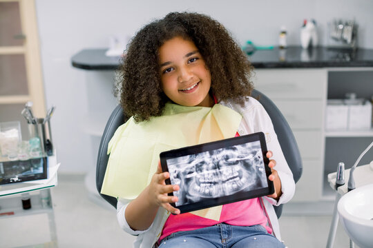 Little Smiling Mixed Raced Girl With Curly Hair Sitting In Dental Chair And Looking At Camera, While Holding X-ray Scan Image Of Her Teeth On Digital Tablet. Pediatric Dentistry, Orthodontics