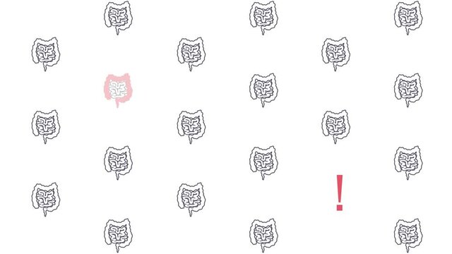 Ulcerative colitis awareness animation. Health screening motion graphics. Pattern of healthy intestines and one affected by the IBD. Medical diagnostic checkup concept. Inflammatory bowel disease.