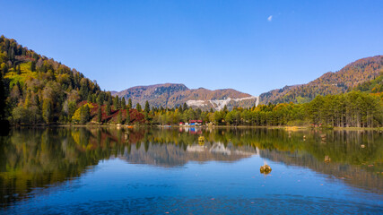 The view that effects us with the fascinating view of the lake and green nature. As additional information, the name of this lake is Karagol and it is located in Artvin/Turkey