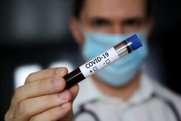 Test tube with covid-19 blood sample in male hand close up. Doctor or scientist with positive coronavirus test	
