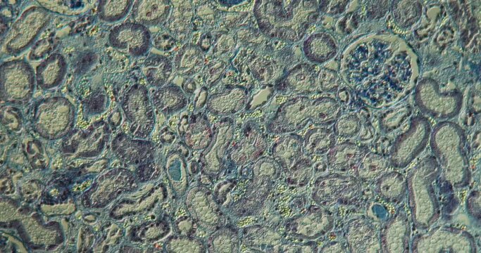 Kidney tissue under the microscope 100x