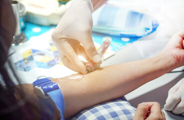  Close-up of a nurse, doctor or medical technician wearing rubber gloves, taking a blood sample from a patient in the hospital. 