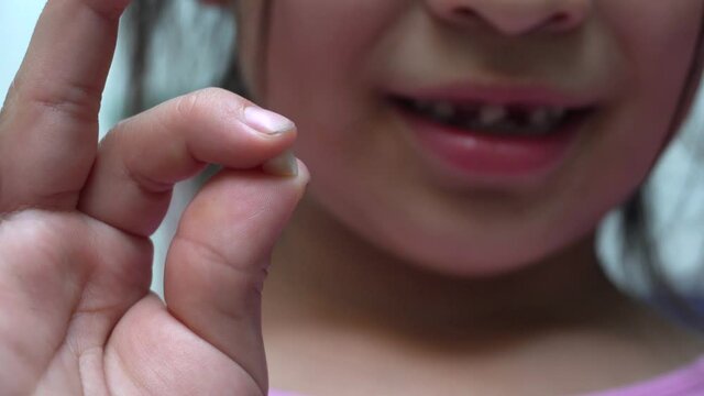 close up of a girl showing her fallen tooth while speaking and showing her teeth out of focus