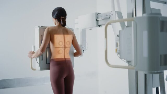 Hospital Radiology Room: Beautiful Multiethnic Woman Standing Topless in the X-Ray Machine