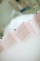 Cardiogram record on the white background in the patient's room in ICU