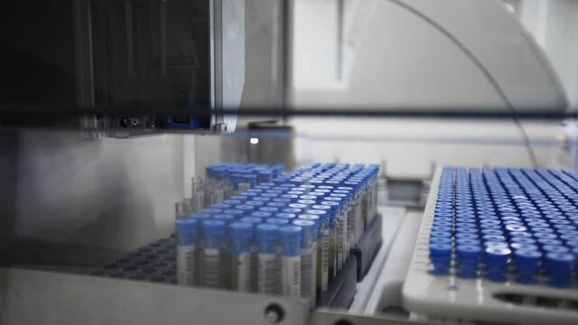 Samples are placed into a machine to be checked in a laboratory room.