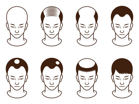 ハゲ頭 Images Browse 563 Stock Photos Vectors And Video Adobe Stock