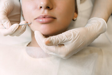 doctor cosmetologist cleans the skin pores of a female patient using a special device