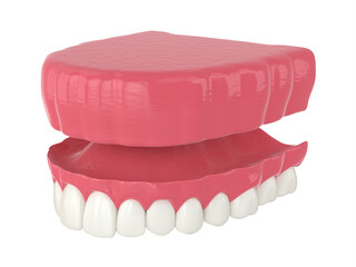 3d render of removable traditional denture installation