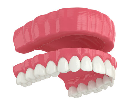 3d render of removable traditional denture installation
