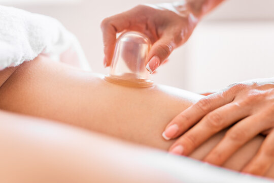 Masseur make massage with jars of cellulite on the buttock and thighs of patient. Treatment of excess weight, anti-cellulite, skin care