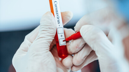 close up. scientist putting a mark on a proven test.