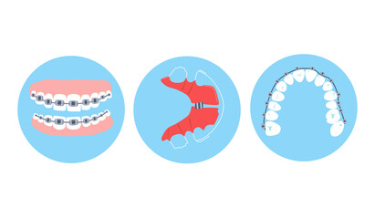 Dental braces, aligner or orthodontic metal retainers on teeth.Oral care and daily routine.Bite correction. Different projections.International day of the dentist.Vector in flat style.Cavity disease