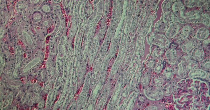 Kidney tissue under the microscope 100x