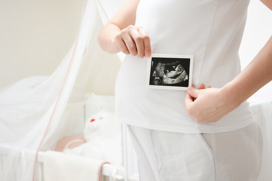 Cropped image of young pregnant woman holding ultrasound picture on belly. Concept of pregnancy, health care, gynecology, medicine. Mother waiting of the baby. Close-up.