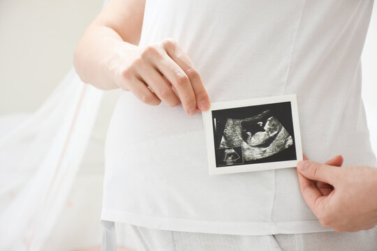 Cropped image of young pregnant woman holding ultrasound picture on belly. Concept of pregnancy, health care, gynecology, medicine. Mother waiting of the baby. Close-up.