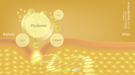 Hyaluronic acid before and after skin solutions ad, gold collagen serum drop with cosmetic advertising background ready to use, illustration vector.	