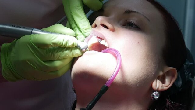Orthodontist removing glue from teeth after removing brackets.