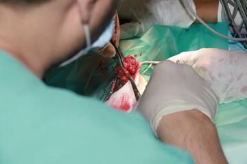 A Veterinary surgeon removes a tumor