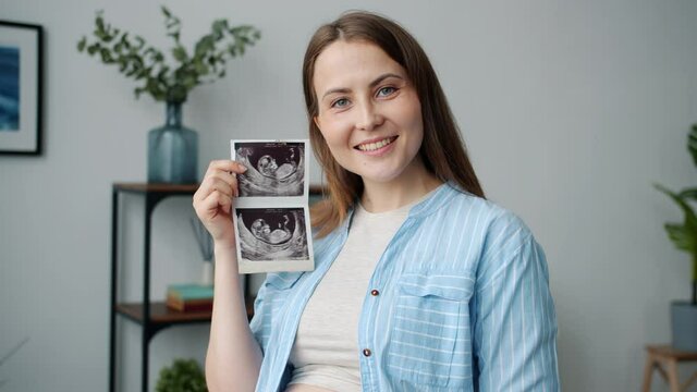Portrait of beautiful young pregnant lady holding ultrasound image smiling and looking at camera in apartment. Motherhood and health concept.