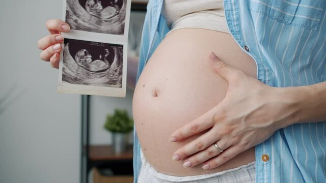 Close-up of pregnant tummy and anonymous woman caressing baby and holding ultrasound image of fetus standing indoors in apartment alone.