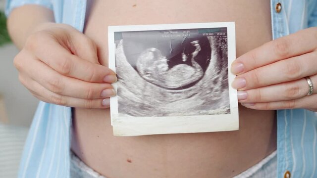 Close-up of ultrasound image of fetus with pregnant belly and woman's hands holding scan in background. Medical treatment and pregnancy concept.