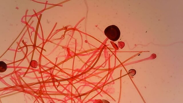 Microscope Rhizopus Whole Mount 1200x