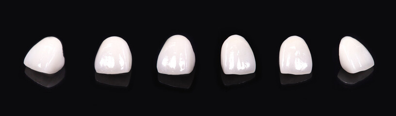 Ceramic dentures and crowns on black background. Top view on set of single dentures and dental...