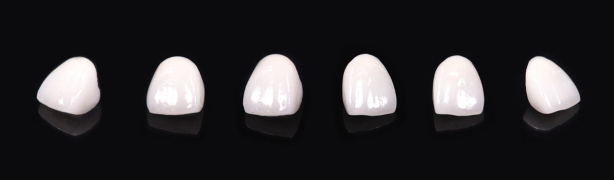 Ceramic dentures and crowns on black background. Top view on set of single dentures and dental crowns. Zirconium crown and zirconium hybrid abutment on isolated black background. 