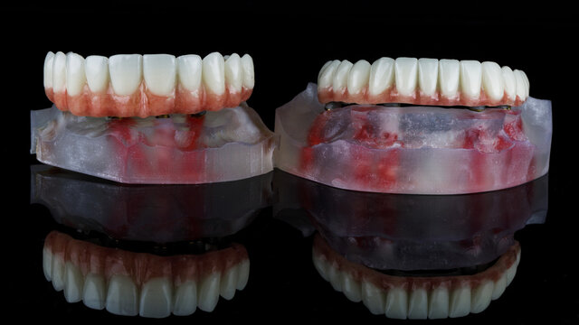 Temporary Wearing Dentures Of The Lower And Upper Jaws With Pink Gums On Dental Models, Removed On Black Glass With Excellent Reflection