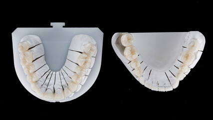 excellent composition for dental crowns and veneers, top view of morphology with black background
