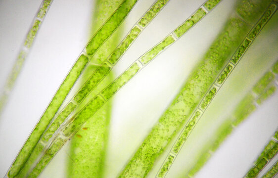 Fuzzy plant cells seen under a microscope
