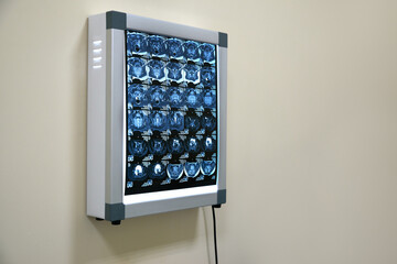 Modern computer device in a hospital room showing mri results