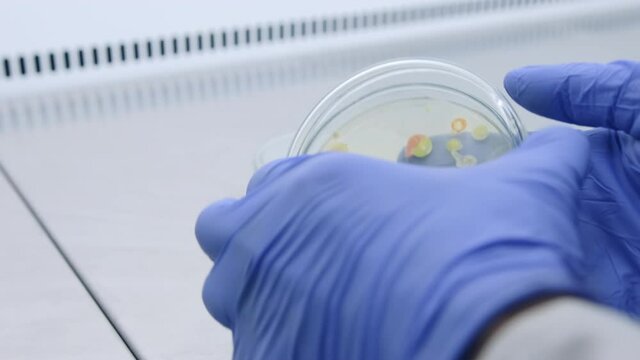 Close-up, the scientist opens, with gloved hands, a Petri dish with bacteria colonies and examines them in a sterile fume hood. Analysis of the results of the study of human microbiota.