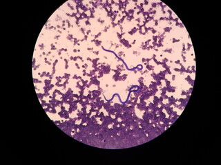 Microfilariae are not sheathed in the blood smear of a dog. Light microscope of heartworms, Dirofilaria immitis.