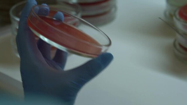 a microbiologist performing a test on a blood sample