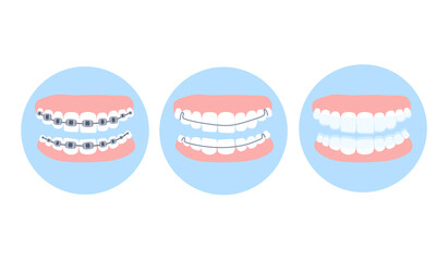 Dental metal braces,essix aligner and Hawley retainer on human teeth. Choice concept.Orthodontic surgery, oral care and hygiene.False jaw.Bruxism treatment and bite correction.Healthy smile.Vector.