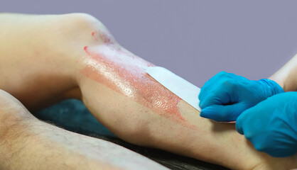 The master cosmetologist removes unwanted hair on the client's legs. The procedure of female hair removal on the legs in a beauty salon. Waxing. The concept of beauty, body care. Selective focus.