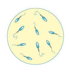 Low sperm count in seminal fluid. Low abundance of sperm in the ejaculate. Male infertility Oligospermia. Spermogram. pathology types. Sperm defects. structure of the sperm. Infographics .
