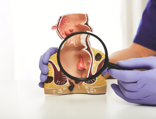 Proctologist with a magnifying glass in his hand showing rectum pathologies on an anatomical model....